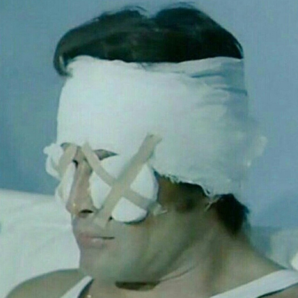alper2
